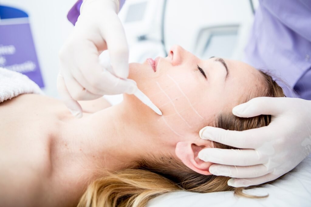 Aesthetic surgery, mesothreads, lifting